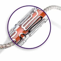 Xience Xpedition Stent